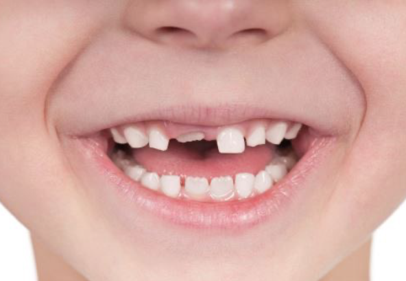 child permanent tooth content-image